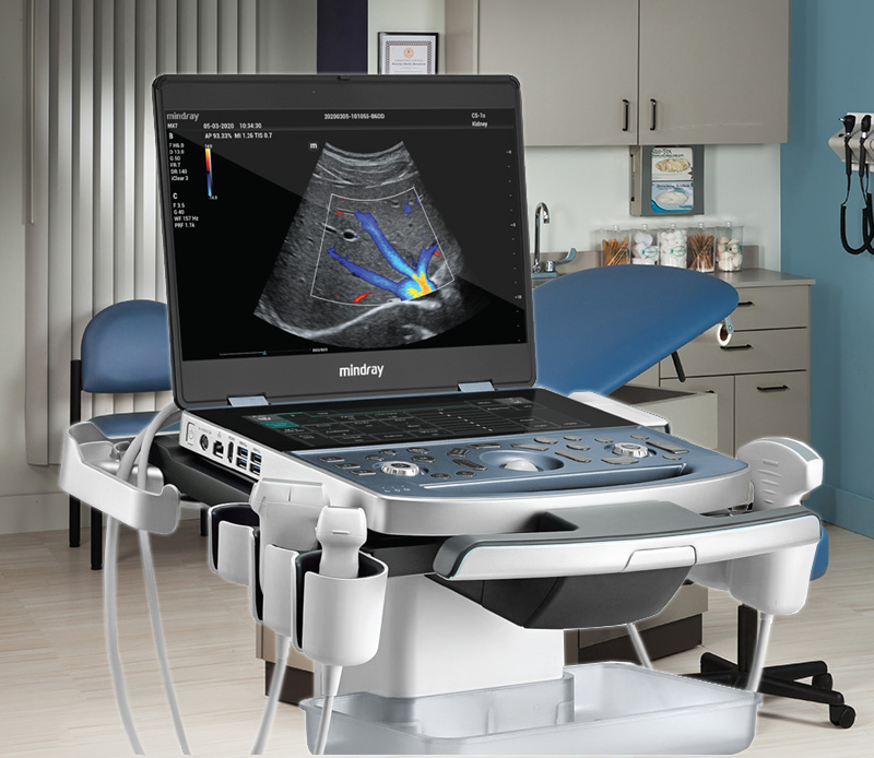Mindray MX7 Portable Ultrasound Machine
